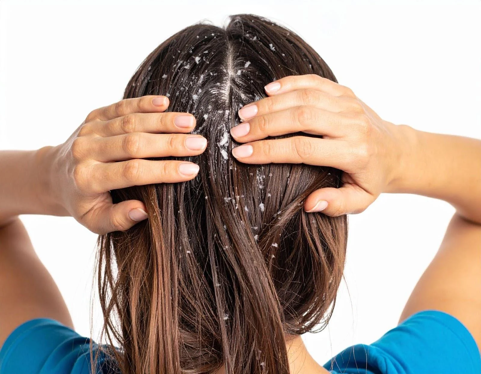 How-to-Remove-Dandruff-from-the-Scalp